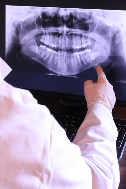 Best Emergency Dental Care for Broken or Chipped Teeth in Dutch Island, GA