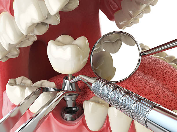 Best Urgent Care for Lost Fillings or Crowns in Dutch Island, GA